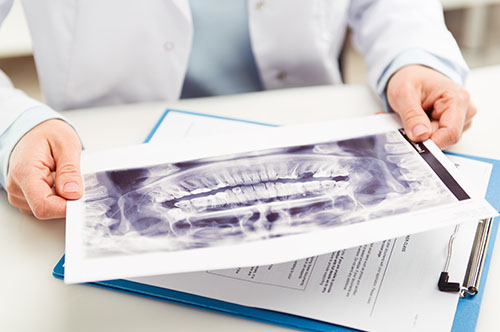 5 Questions to Ask About Your Oral Health Before the Year Ends